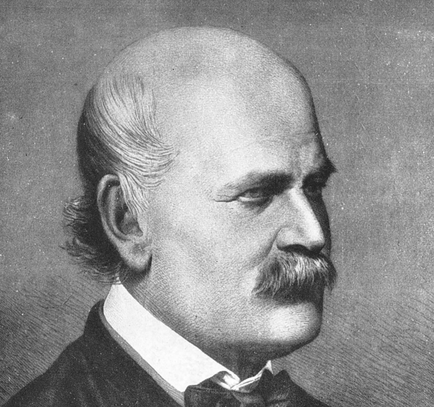 Ritratto di Ignaz Semmelweis, 1860.